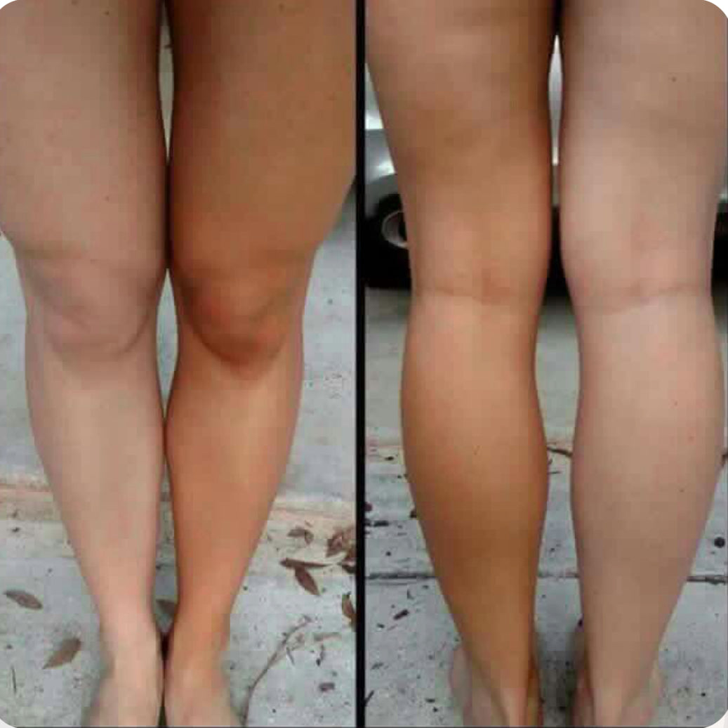 BRONZE - Mousse Auto bronzante